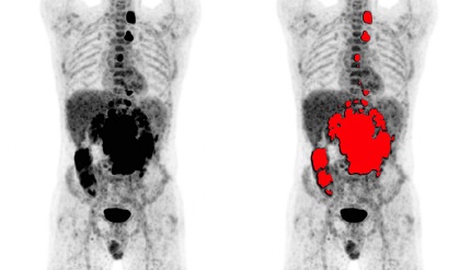 IMAS. UPV, CSIC y UV, a por un novedoso esc�ner PET de diagn�stico cl�nico