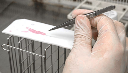 Nervous system injuries. Researchers have designed new neurocables for repairing them